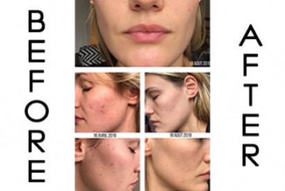 Before / After of Customers